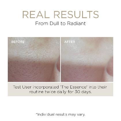 Lumière de Vie&reg; The Essence (Hydrating Tonic)