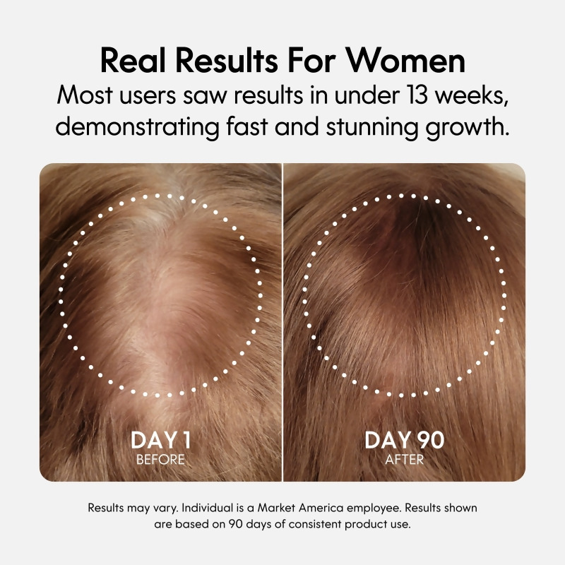Fixx&trade; Hair Growth