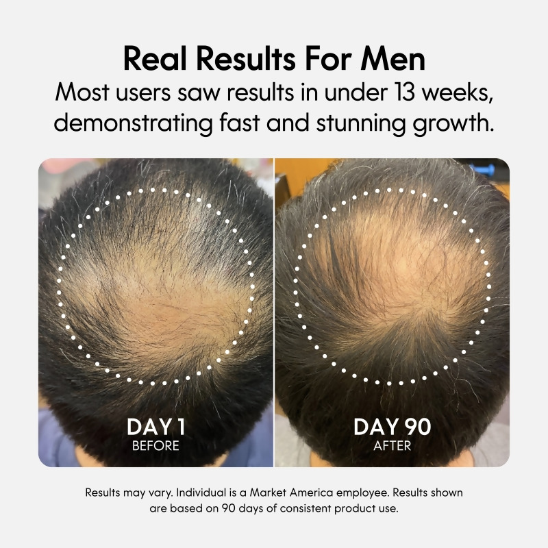 Fixx&trade; Hair Growth