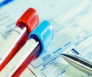 Cholesterol Levels