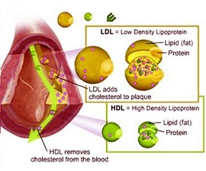 Good Cholesterol vs Bad Cholesterol