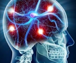 Stress Response