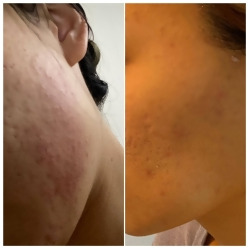 Customer Review Image 2 of 2, Zoom In