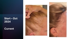 Customer Review Image 1 of 3, Zoom In